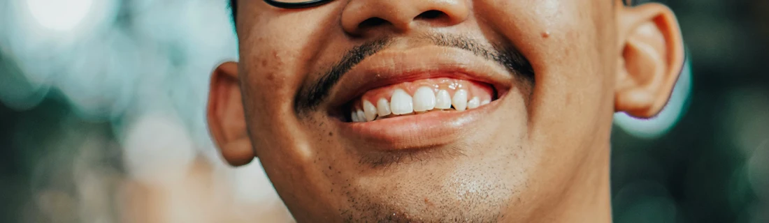 Dentist Tuscaloosa AL Tooth Extraction Focused close up of a teenager's mouth while he is smiling